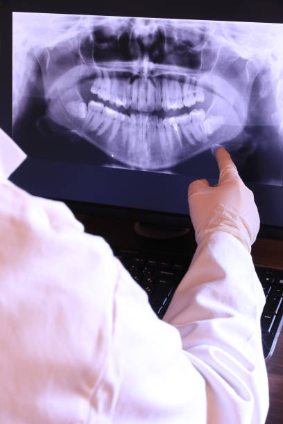 Best Emergency Dental Extractions in Buena Vista, GA